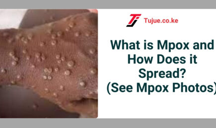 What is Mpox and How Does it Spread?